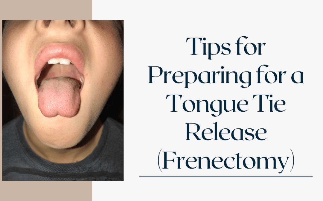 Tips for Preparing for a Tongue Tie Release (Frenectomy)